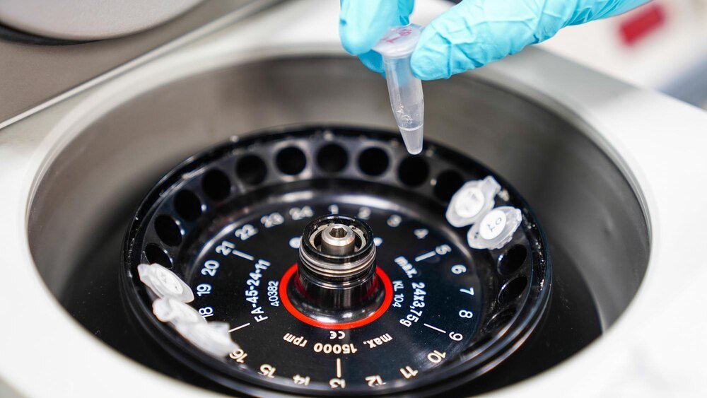 Samodzielne czyszczenie turbiny – jak używać środka do czyszczenia turbo